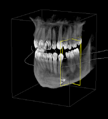 A 3D image created with Cone Beam technology.